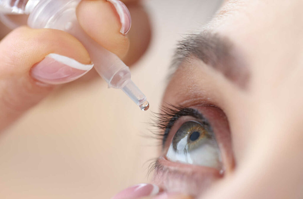 A woman putting eye drops in her eye to lubricate her eyes and relieve the discomfort caused by dry eyes.